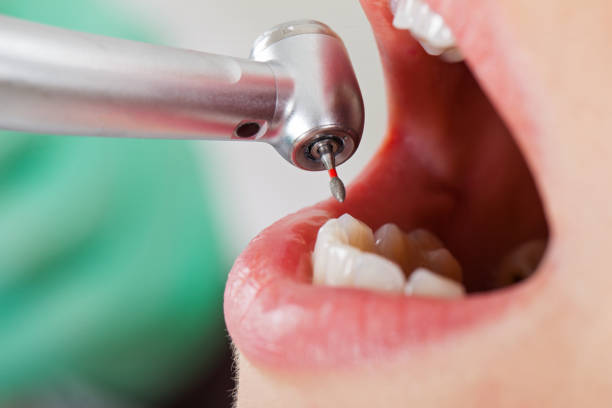 Best Root Canal Emergency Dentist  in Danbury, CT